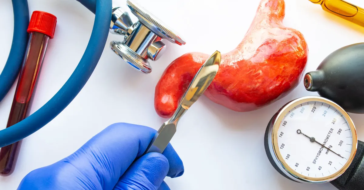 Bariatric surgery on the NHS- great outcomes if you can access it